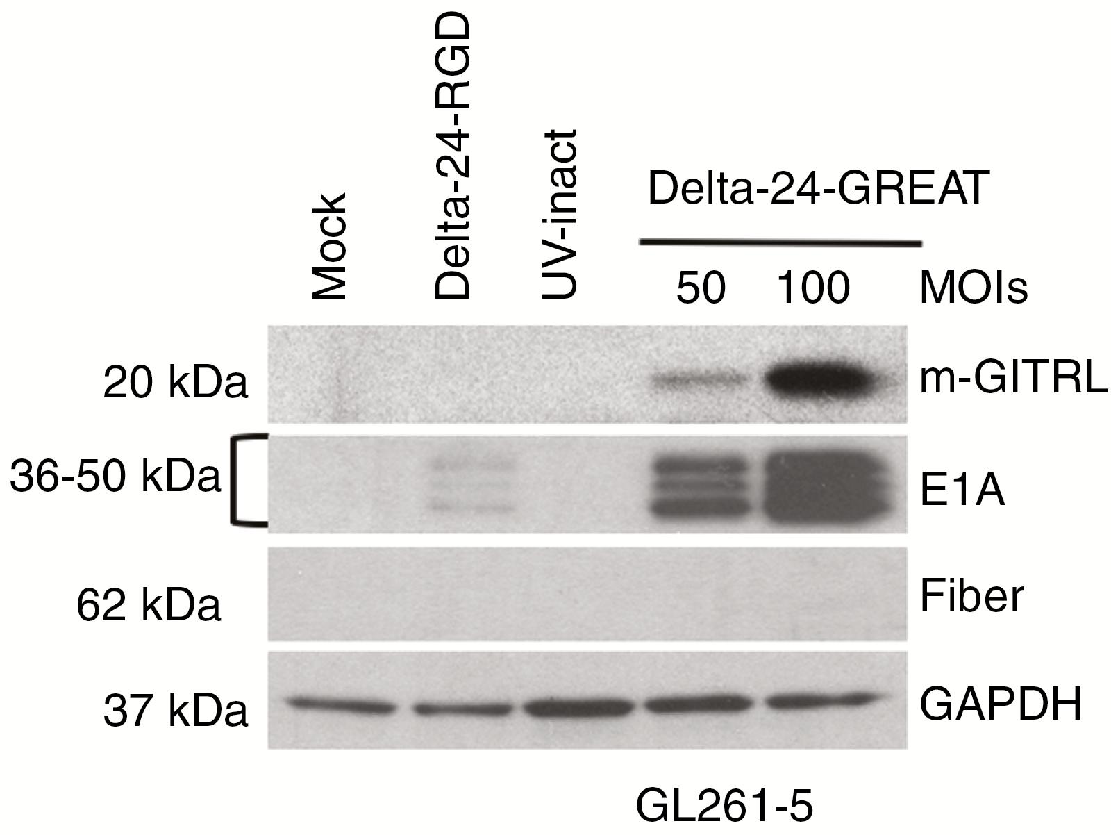 Western Blot is used to detect the expression of target proteins. (OA Literature)